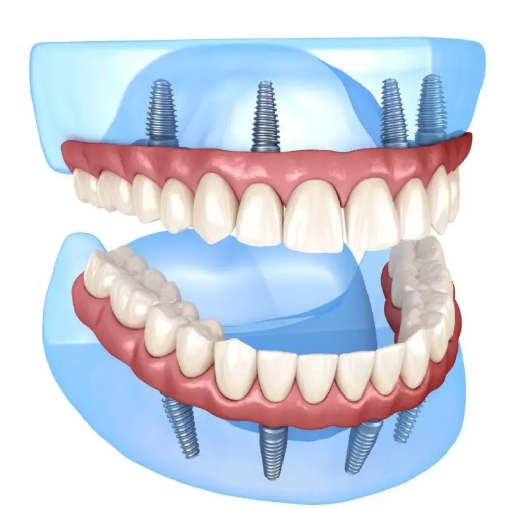Dr. Ahdout dental practice gallery image 577