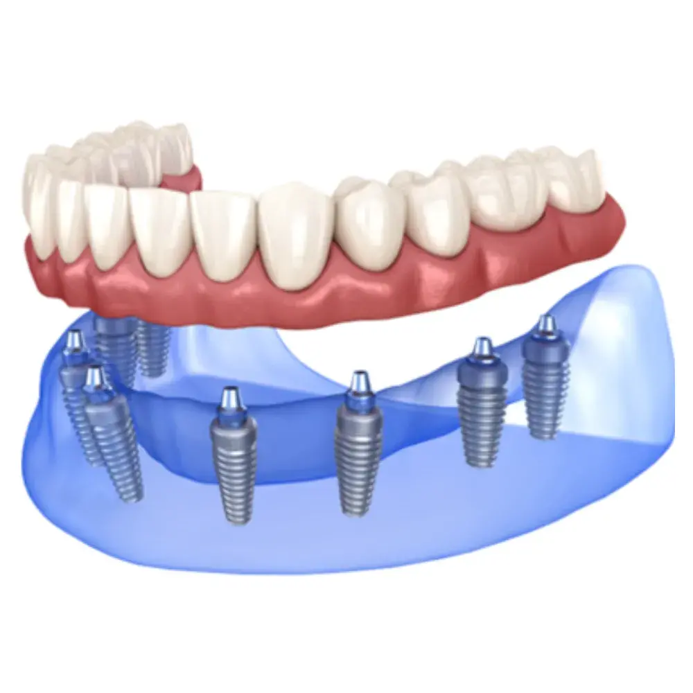 Dr. Ahdout dental practice gallery image 612