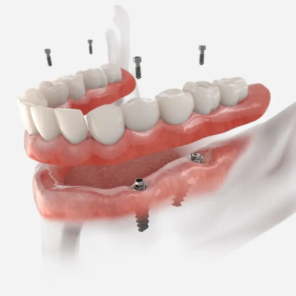 Dr. Ahdout dental practice gallery image 628