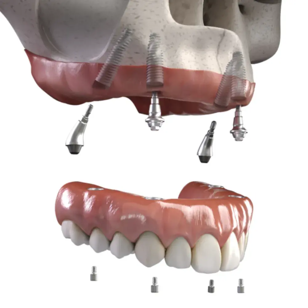 Dr. Ahdout dental practice gallery image 610