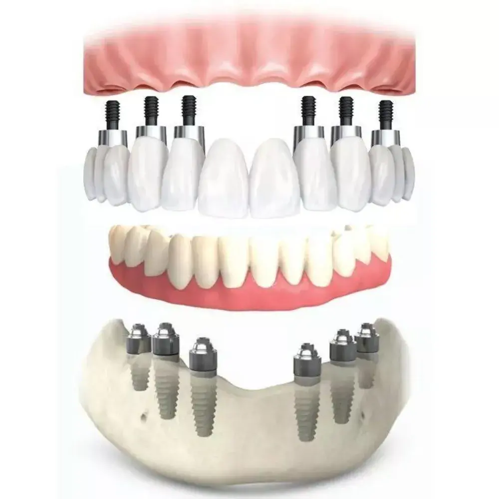 Dr. Ahdout dental practice gallery image 608