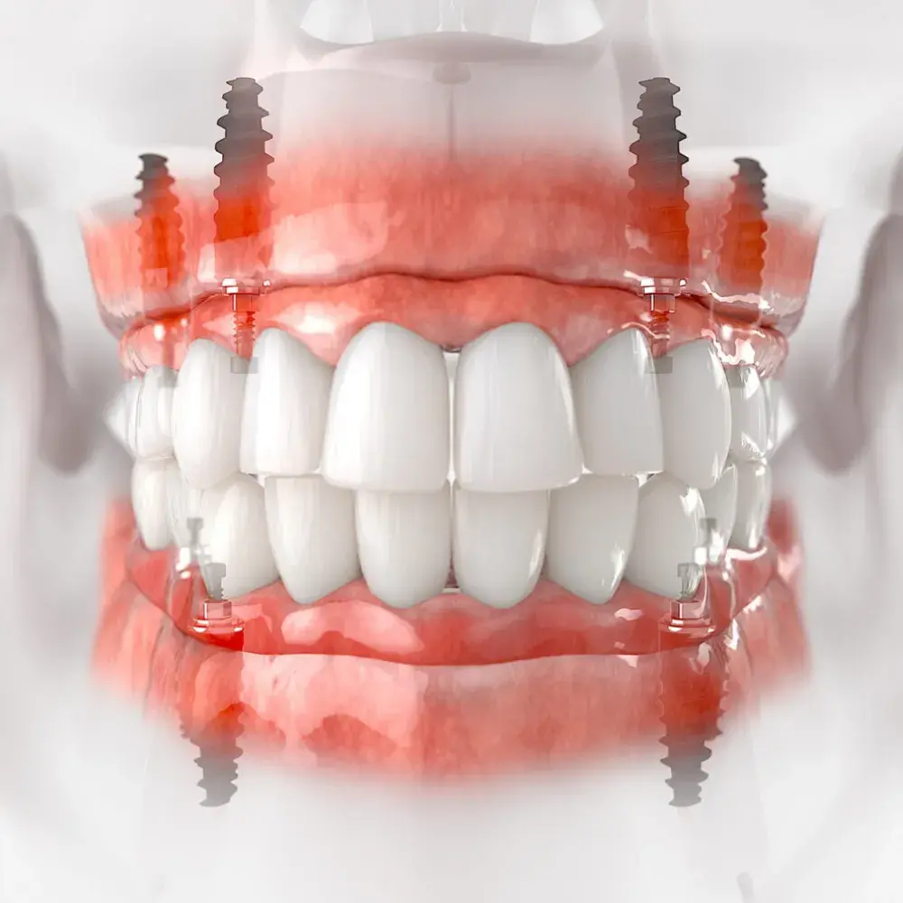 Dr. Ahdout dental practice gallery image 582