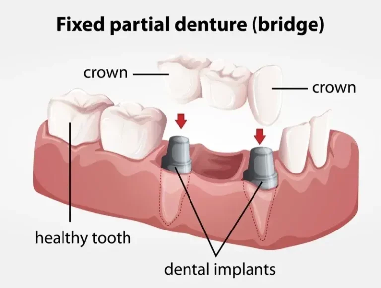 Dr. Ahdout dental practice gallery image 596