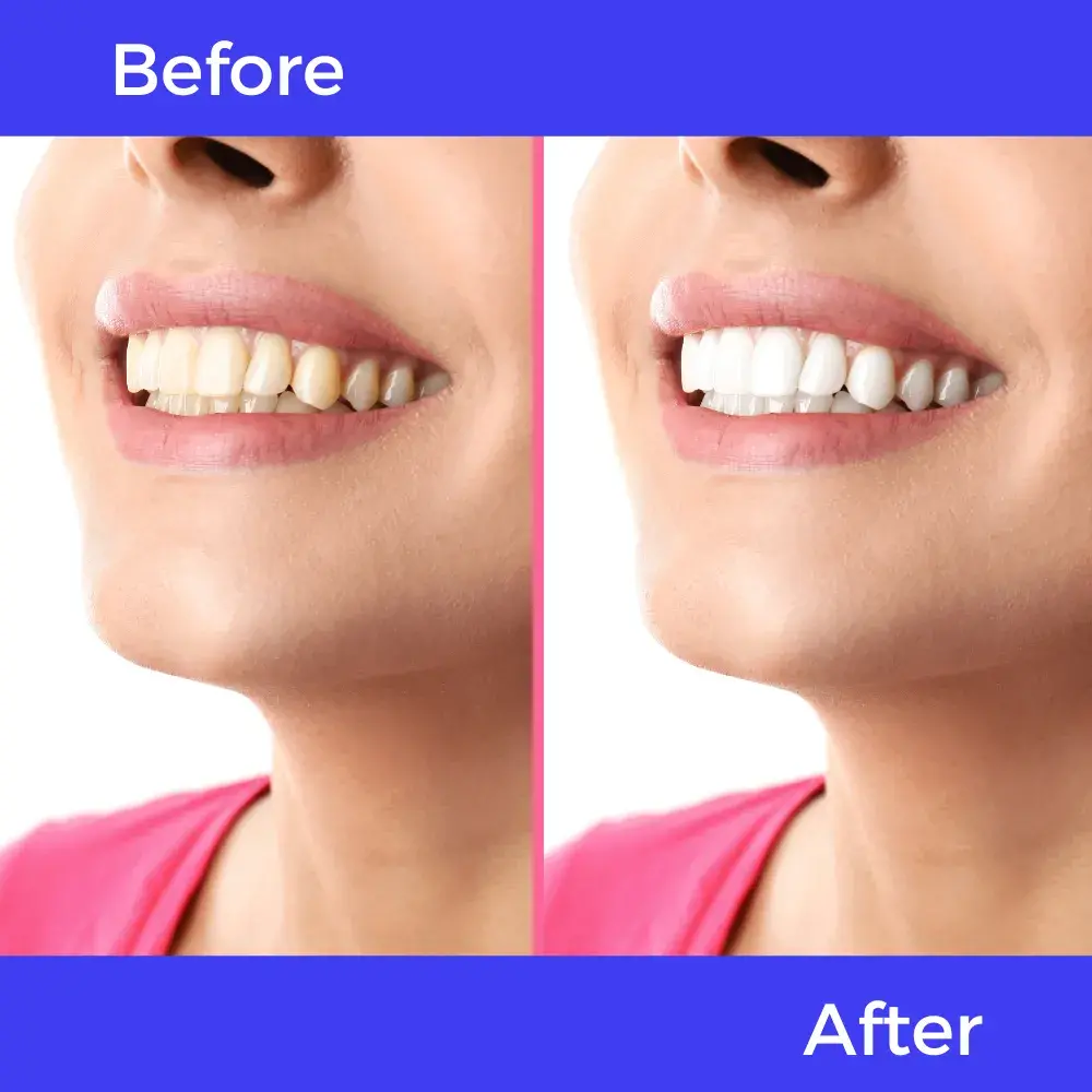 Choosing the Right Sedation Dentist: Questions You Must Ask Before Your Appointment
