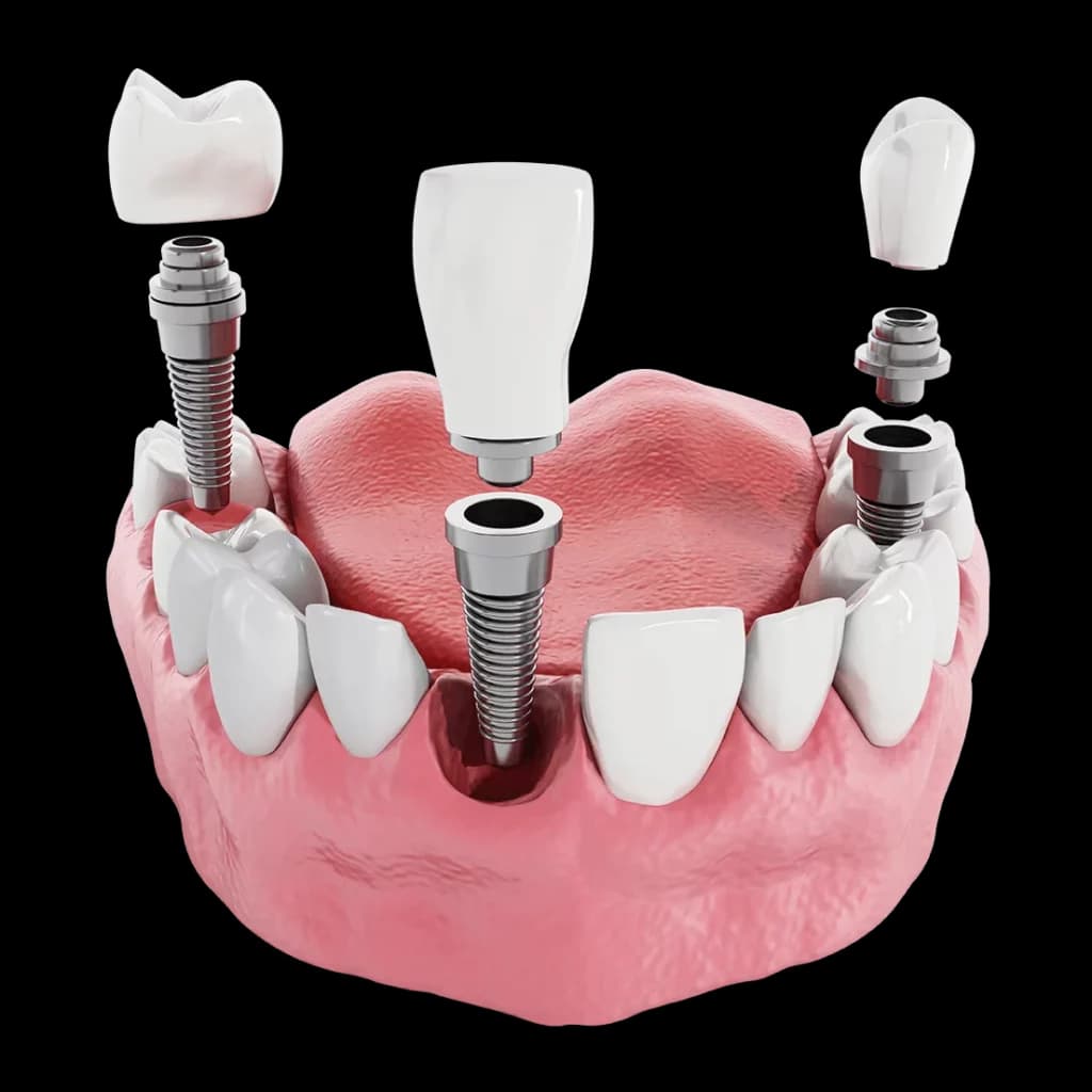 Dr. Ahdout dental practice gallery image 287