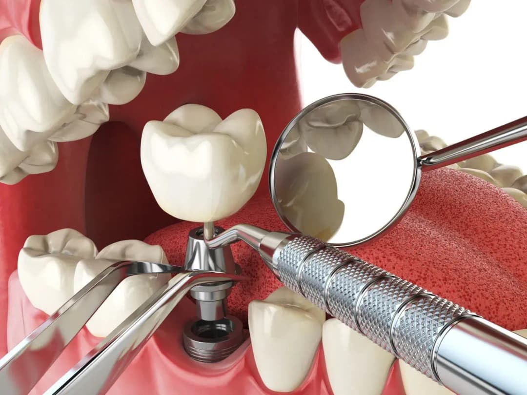 Dr. Ahdout dental practice gallery image 293