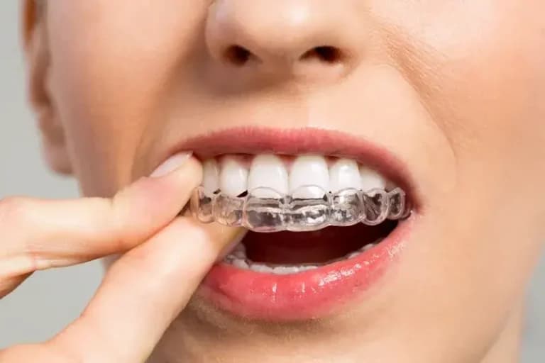 Dr. Ahdout dental practice gallery image 609