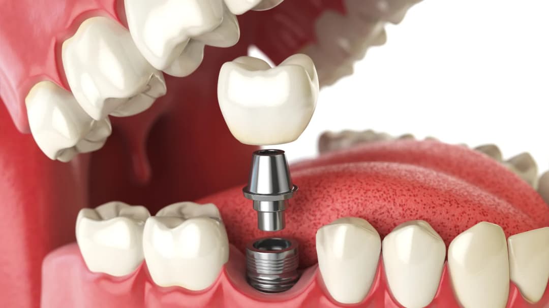 Dr. Ahdout dental practice gallery image 432
