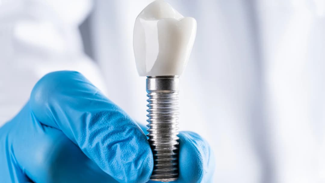 Dr. Ahdout dental practice gallery image 412