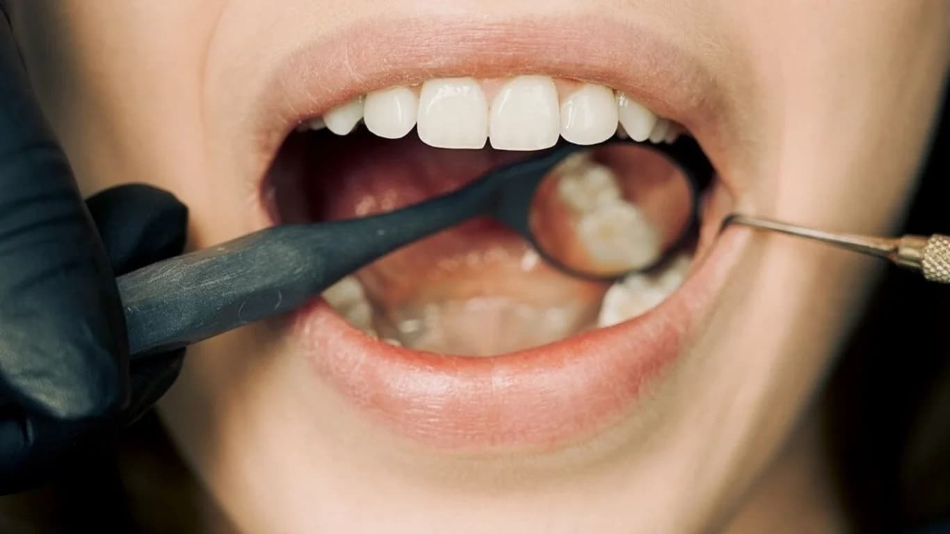 What You Need to Know About Visiting an Emergency Dentist