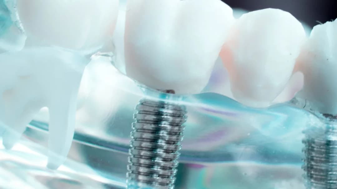 Dr. Ahdout dental practice gallery image 513