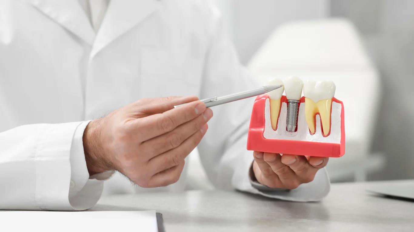 Key Factors to Consider When Choosing the Right Implant Dentist for Your Smile