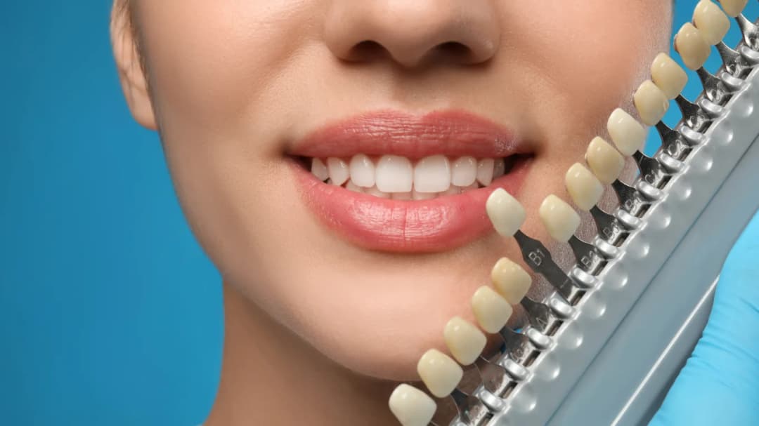 Dr. Ahdout dental practice gallery image 325