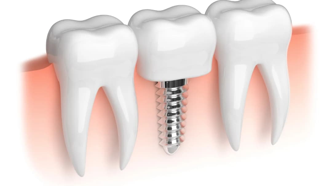 Dr. Ahdout dental practice gallery image 590