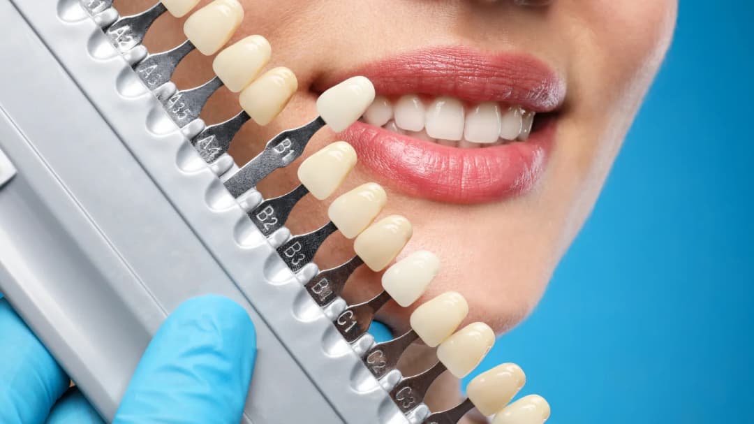 Dr. Ahdout dental practice gallery image 301