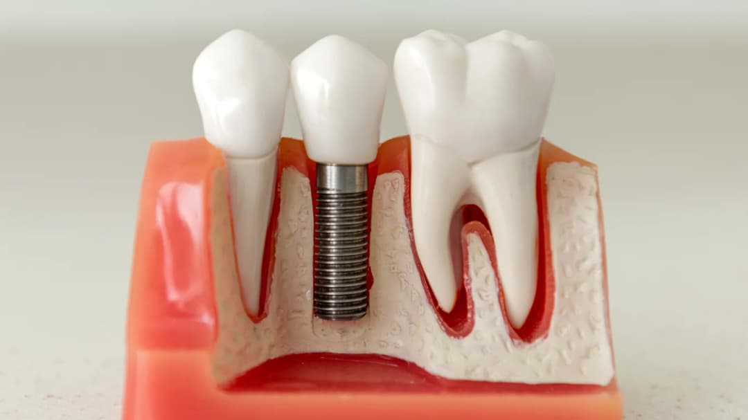 Dr. Ahdout dental practice gallery image 531