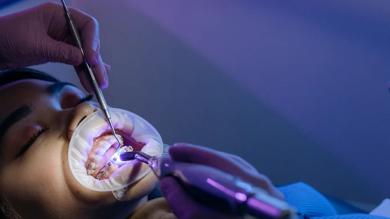 The Benefits of Sedation Dentistry: Stress-Free Dental Visits Explained