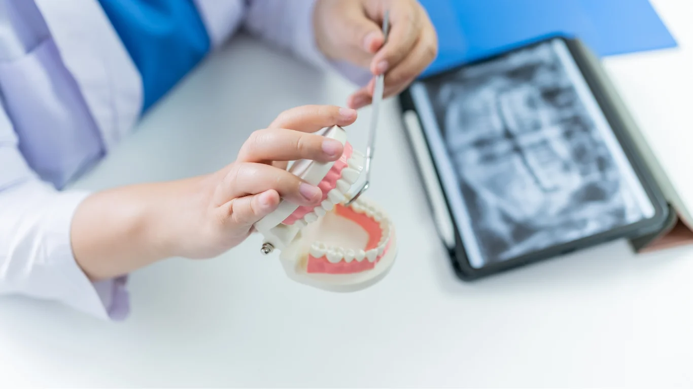 Why Dental Implants Are the Preferred Solution for Missing Teeth