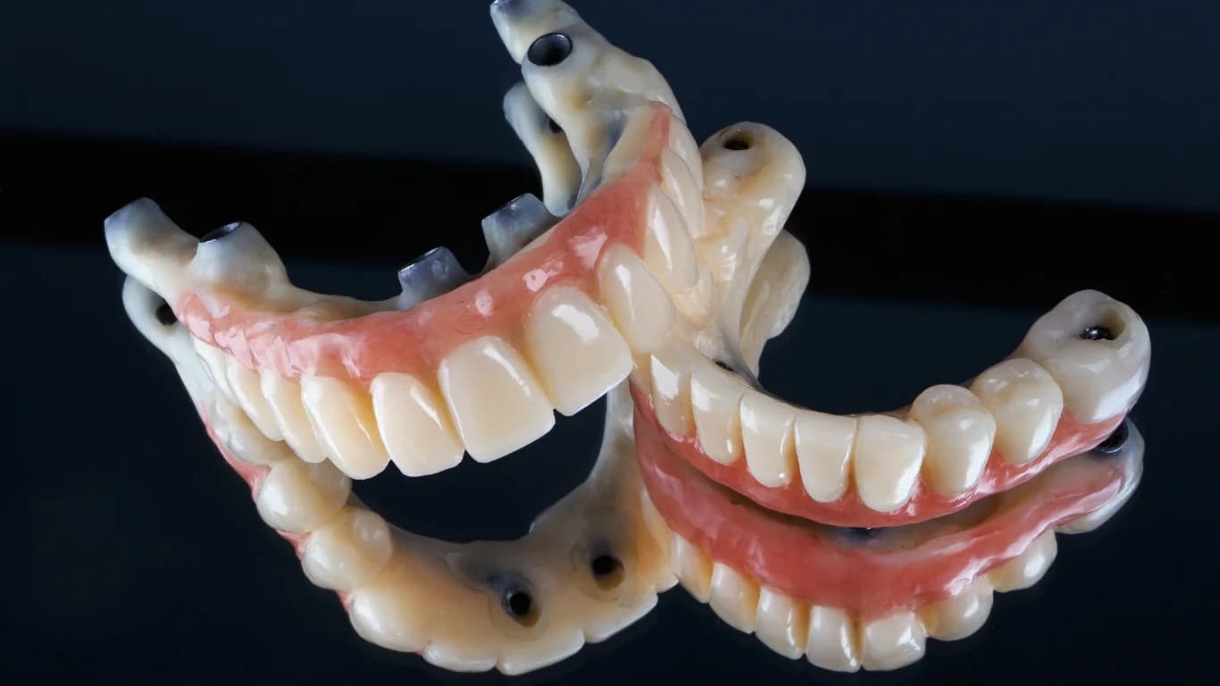 Understanding All on 4 Dental Implants: A Complete Guide for Patients