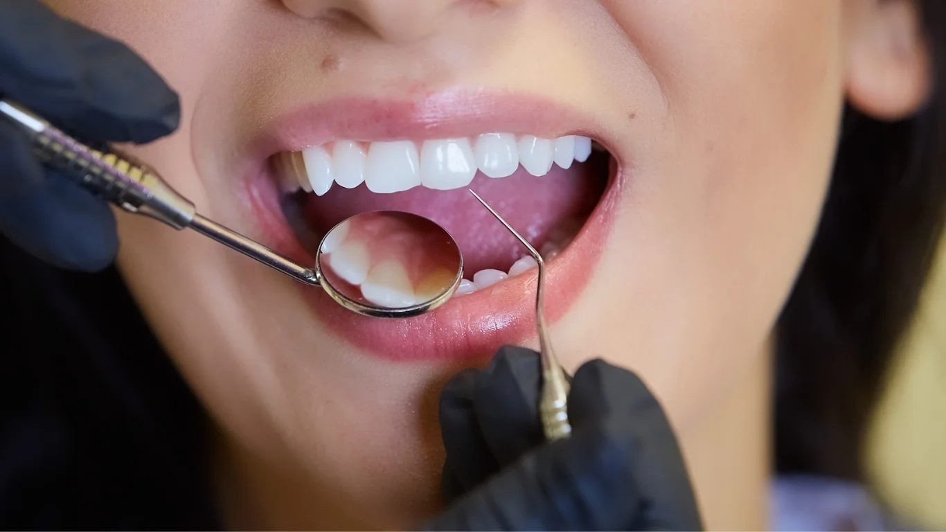 The Role of General Dentistry in Early Detection and Preventive Care