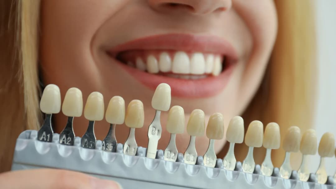 Dr. Ahdout dental practice gallery image 479