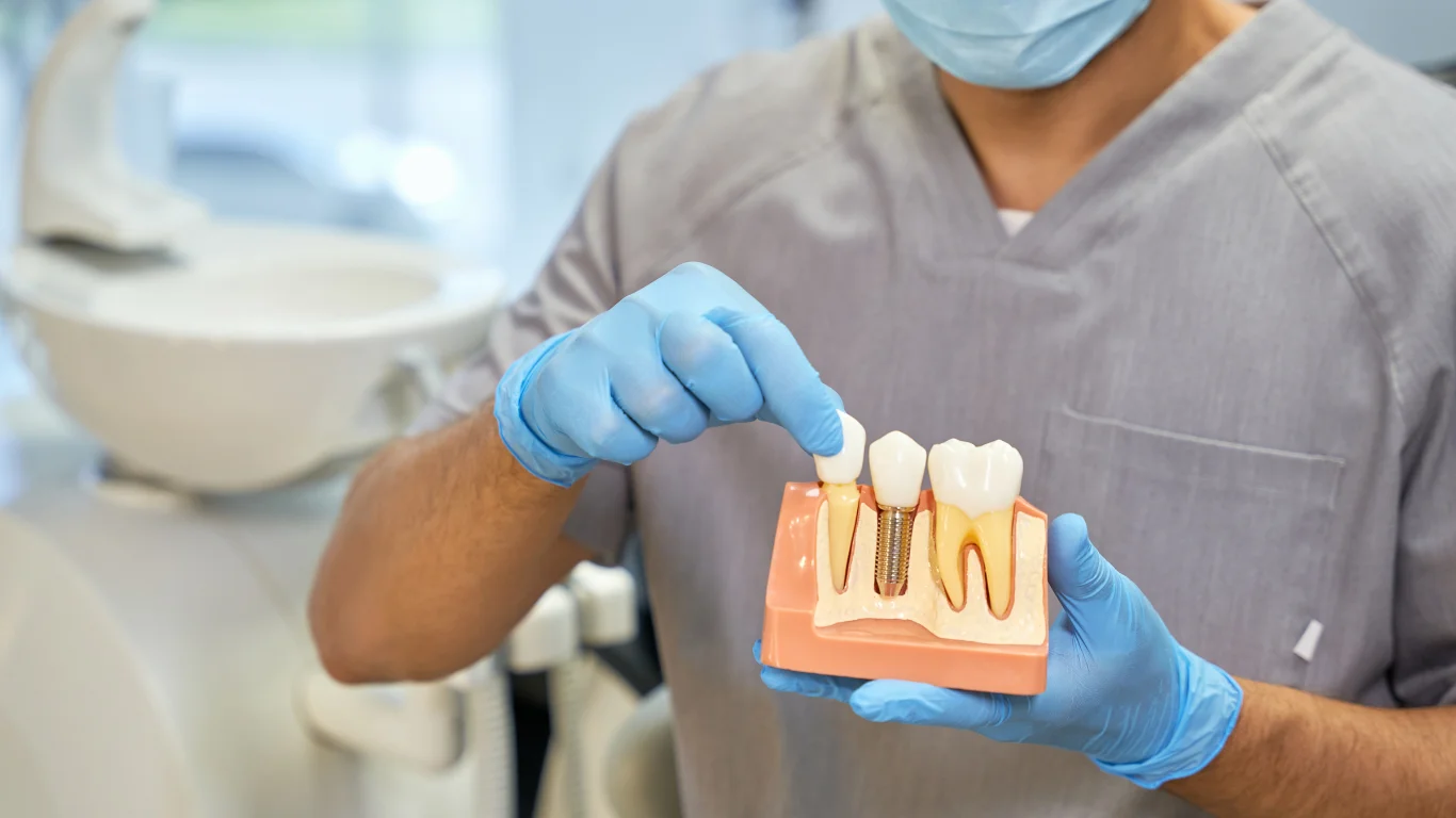 The Top Benefits of Dental Implants for Restoring Your Smile