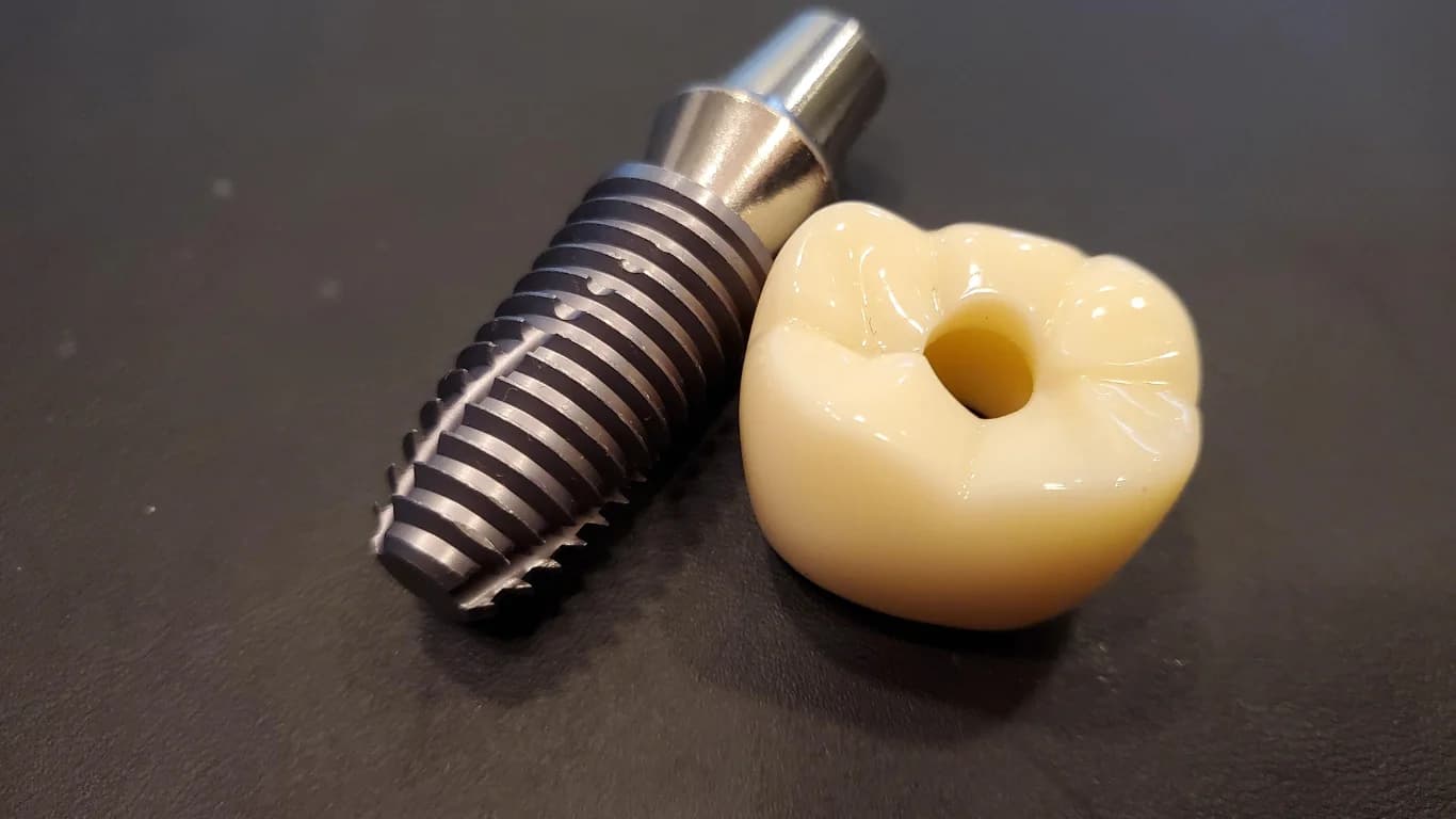 How Dental Implants Enhance Functionality and Aesthetics