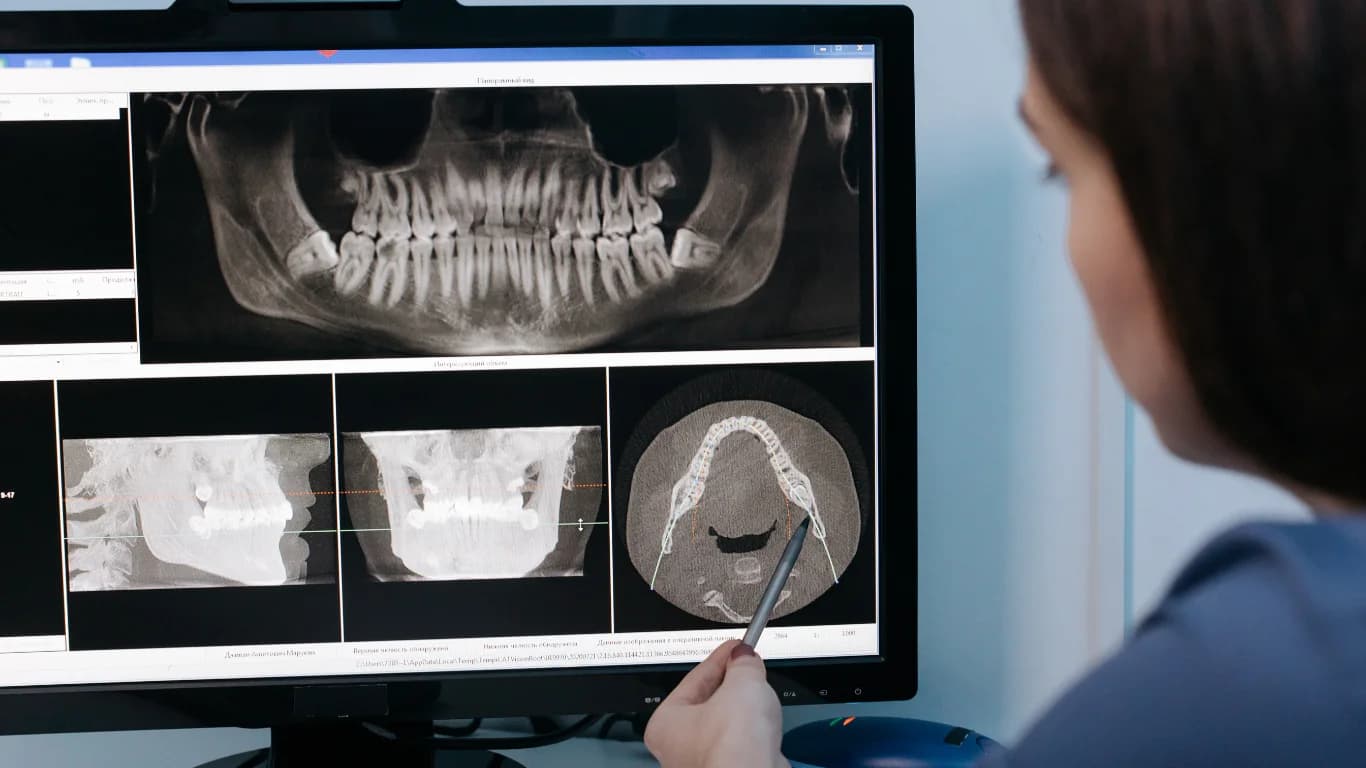 How to Choose the Right Implant Dentist for Successful Dental Implants
