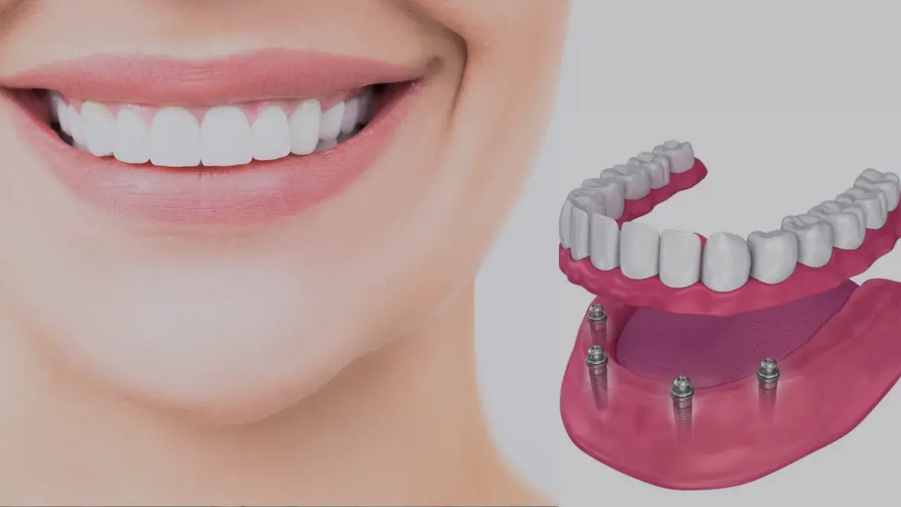 Finding the Right Dentist in Canoga Park for Modern, High-Tech Care