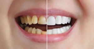 cosmetic dentist