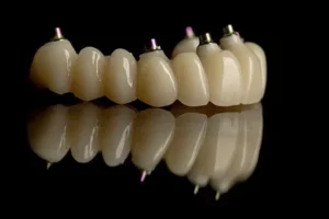 all on 6 dental implants