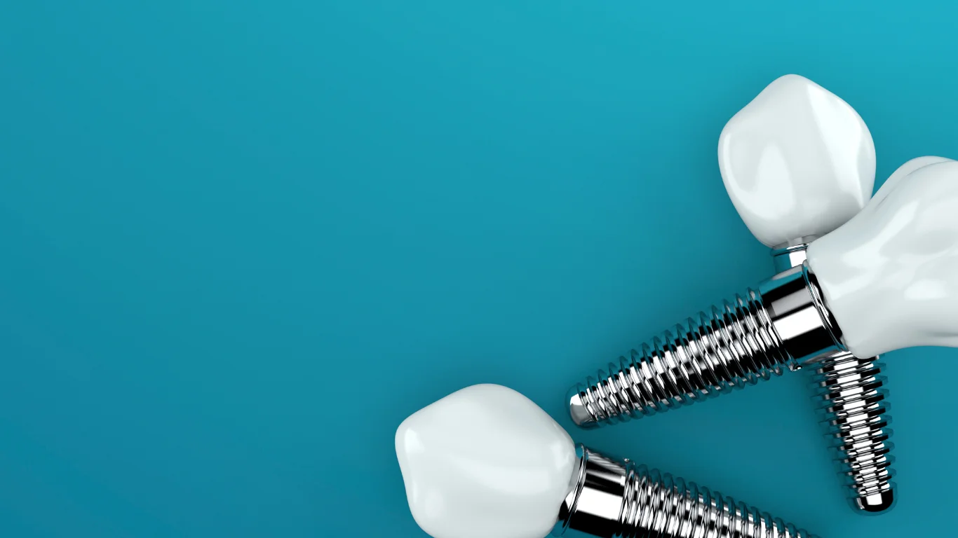 Dental Implant