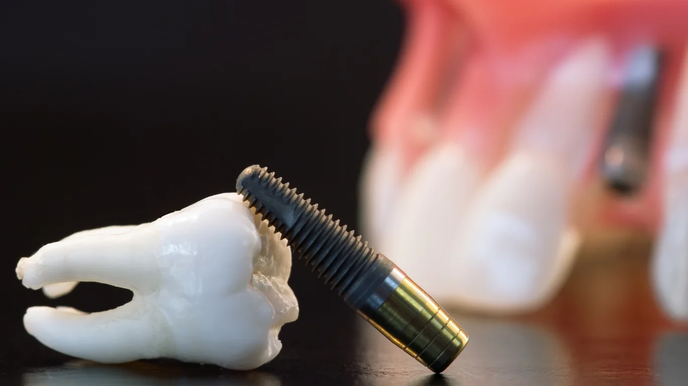 Implant Dentist