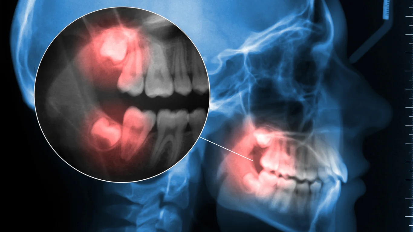 Emergency Dentist