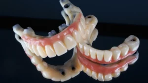 All on 4 Dental Implants