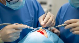 recovery after a wisdom tooth extraction?