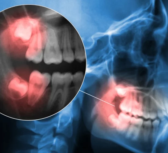 Emergency Dentist